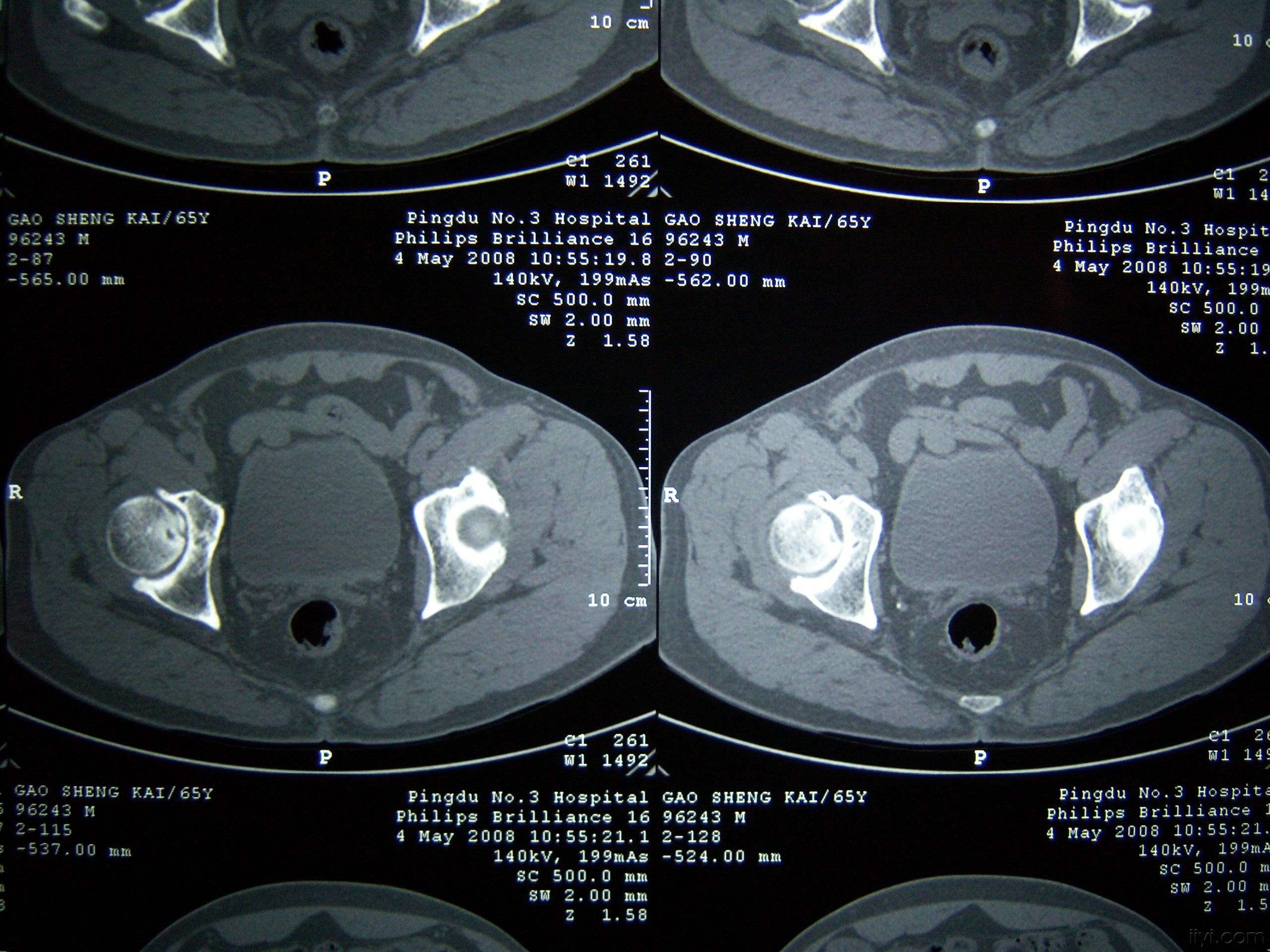 乌鲁木齐沙依巴克区水疗学生【⒘35⒑⒔媺】面半-百度ai开放平台-全球